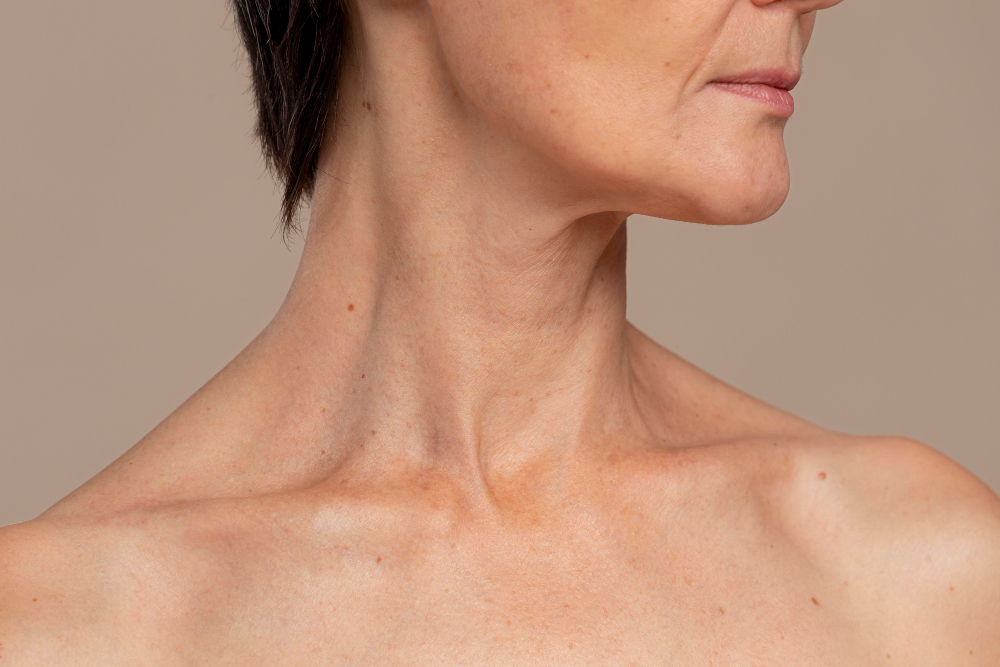 Cou et décolleté – conditions esthétique Montréal
