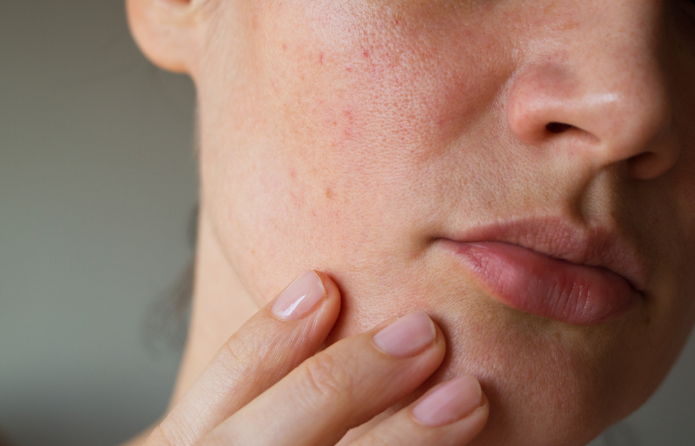 Peau et texture – conditions esthétiques traitées